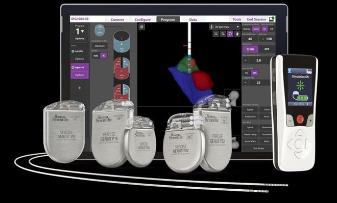 获批CE!波士顿科学神经导航软件(图1) 获批CE!波士顿科学神经导航软件(图1)