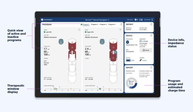 获批CE!波士顿科学神经导航软件(图4) 获批CE!波士顿科学神经导航软件(图4)