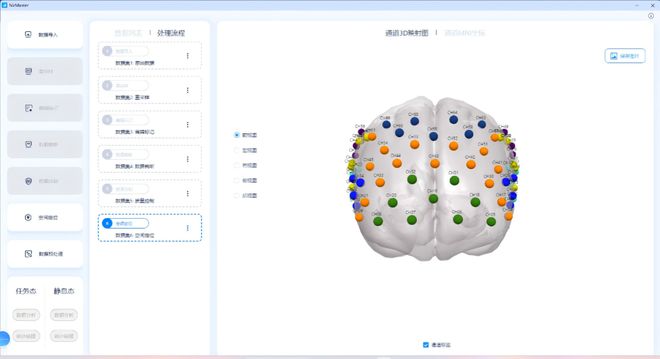 详解国内首款fNIRS全中文数据分析软件——NirMaster(图6)